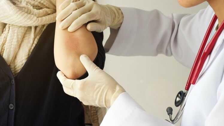 The doctor checks the elbow for psoriasis